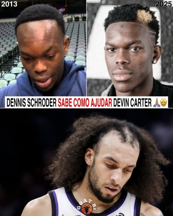 网友晒施罗德发际线逆生长对比图调侃德文-卡特 ：他知道怎么帮你